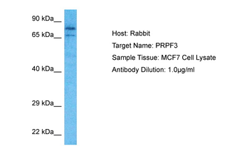 PRPF3 Rabbit Polyclonal Antibody