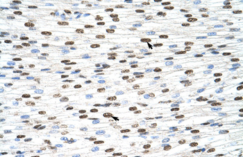 HNRNPDL Rabbit Polyclonal Antibody