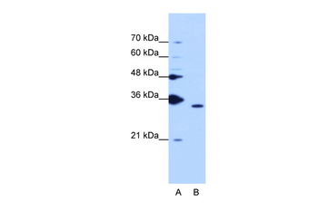 PPIE Rabbit Polyclonal Antibody