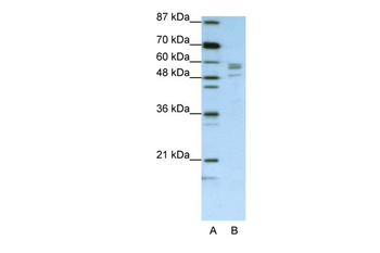 SARS Rabbit Polyclonal Antibody