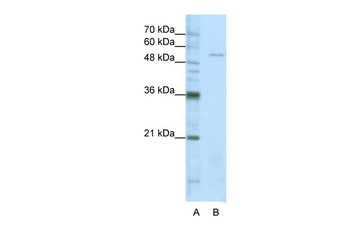 SARS Rabbit Polyclonal Antibody