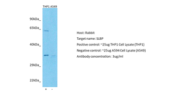 SLBP Rabbit Polyclonal Antibody