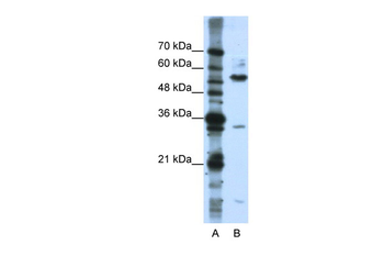 KHDRBS3 Rabbit Polyclonal Antibody