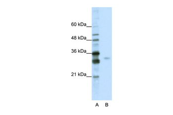 SFRS1 Rabbit Polyclonal Antibody