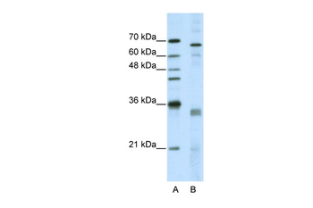SFRS1 Rabbit Polyclonal Antibody