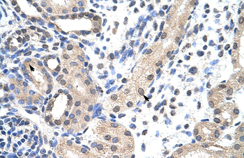 SNRPD1 Rabbit Polyclonal Antibody