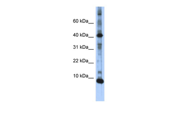 LSM6 Rabbit Polyclonal Antibody
