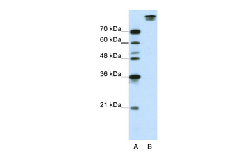 SF3B1 Rabbit Polyclonal Antibody