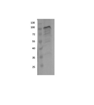 EWSR1 Rabbit Polyclonal Antibody