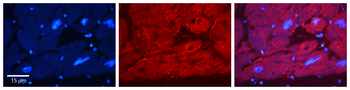 EWSR1 Rabbit Polyclonal Antibody
