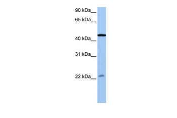 EWSR1 Rabbit Polyclonal Antibody