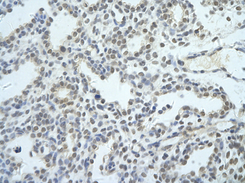 NIP7 Rabbit Polyclonal Antibody