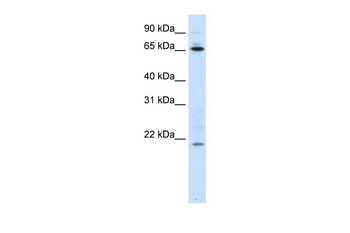 NIP7 Rabbit Polyclonal Antibody