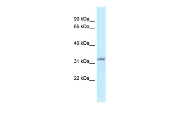 Hsd17b11 Rabbit Polyclonal Antibody