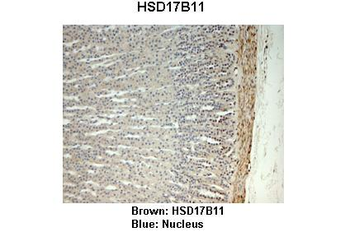 HSD17B11 Rabbit Polyclonal Antibody
