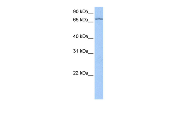 LARP7 Rabbit Polyclonal Antibody