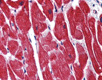 STAU1 Rabbit Polyclonal Antibody