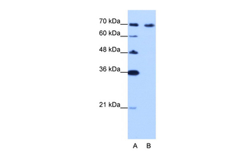 CARF Rabbit Polyclonal Antibody