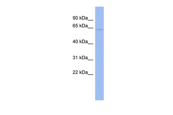 CDKN2AIP Rabbit Polyclonal Antibody