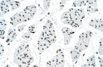 RBM22 Rabbit Polyclonal Antibody