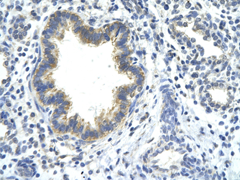 KLHDC8A Rabbit Polyclonal Antibody