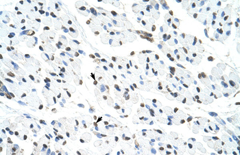 MATR3 Rabbit Polyclonal Antibody