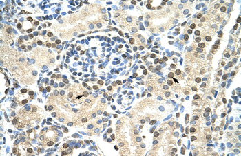 DAZAP1 Rabbit Polyclonal Antibody