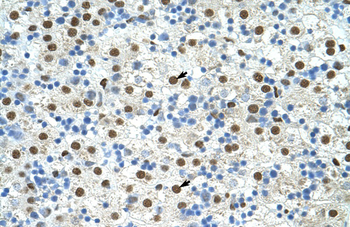 EXOSC4 Rabbit Polyclonal Antibody