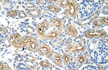 MIF4GD Rabbit Polyclonal Antibody