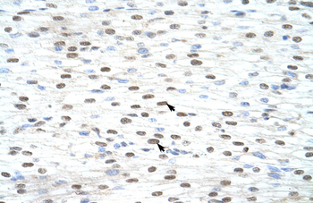 LSM2 Rabbit Polyclonal Antibody