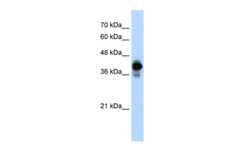 HNRPC Rabbit Polyclonal Antibody