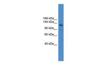 LARP1 Rabbit Polyclonal Antibody