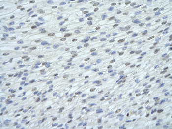 SRSF10 Rabbit Polyclonal Antibody