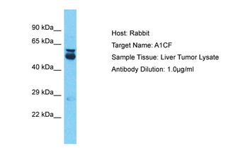 A1CF Rabbit Polyclonal Antibody