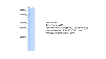 A1CF Rabbit Polyclonal Antibody