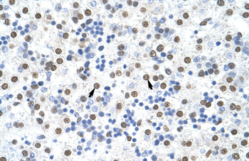 MSI2 Rabbit Polyclonal Antibody