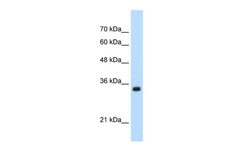 APOBEC3D Rabbit Polyclonal Antibody