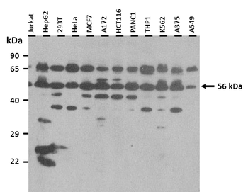 SLA Rabbit Polyclonal Antibody