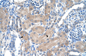 SLA Rabbit Polyclonal Antibody