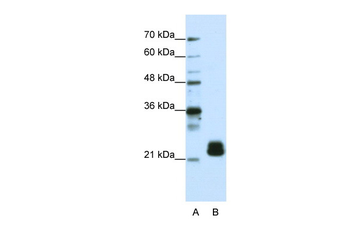 TMED4 Rabbit Polyclonal Antibody