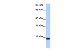 TMED4 Rabbit Polyclonal Antibody