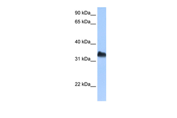 DND1 Rabbit Polyclonal Antibody