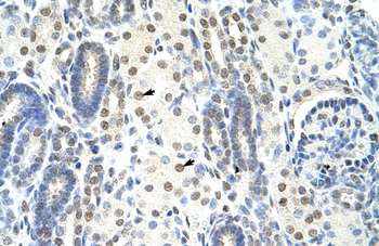 SF1 Rabbit Polyclonal Antibody