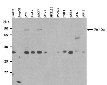 FZD6 Rabbit Polyclonal Antibody
