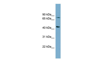 FZD6 Rabbit Polyclonal Antibody