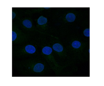 FZD10 Rabbit Polyclonal Antibody