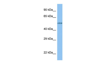 VANGL1 Rabbit Polyclonal Antibody