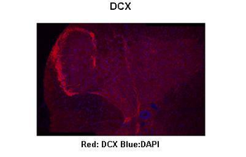 DCX Rabbit Polyclonal Antibody