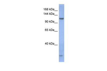 PIWIL1 Rabbit Polyclonal Antibody