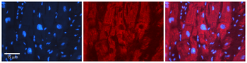 EFEMP1 Rabbit Polyclonal Antibody